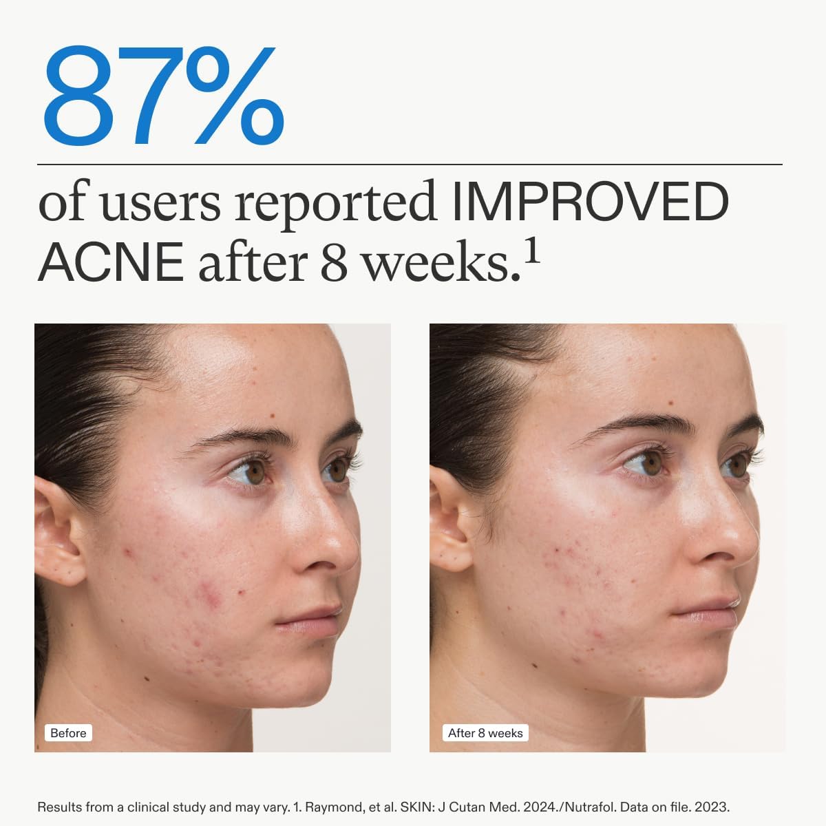 Nutrafol Clear Skin Acne Supplement for Women, Clinically Tested for Clearer, Smoother Skin, Physician-Formulated, Vegan