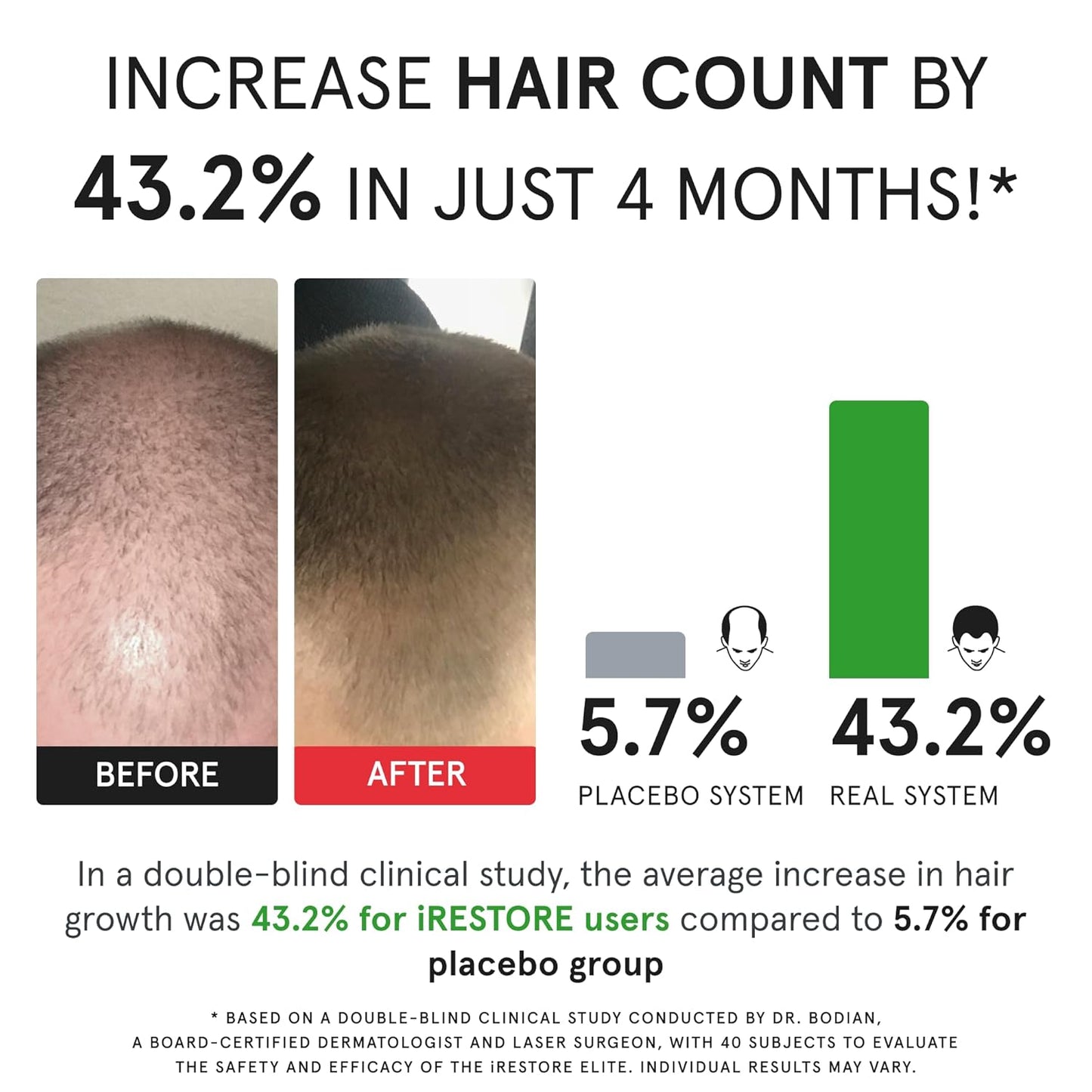 iRestore Skincare & Hair Care Power Duo – LED Therapy for Radiant Skin & Laser Hair Growth System