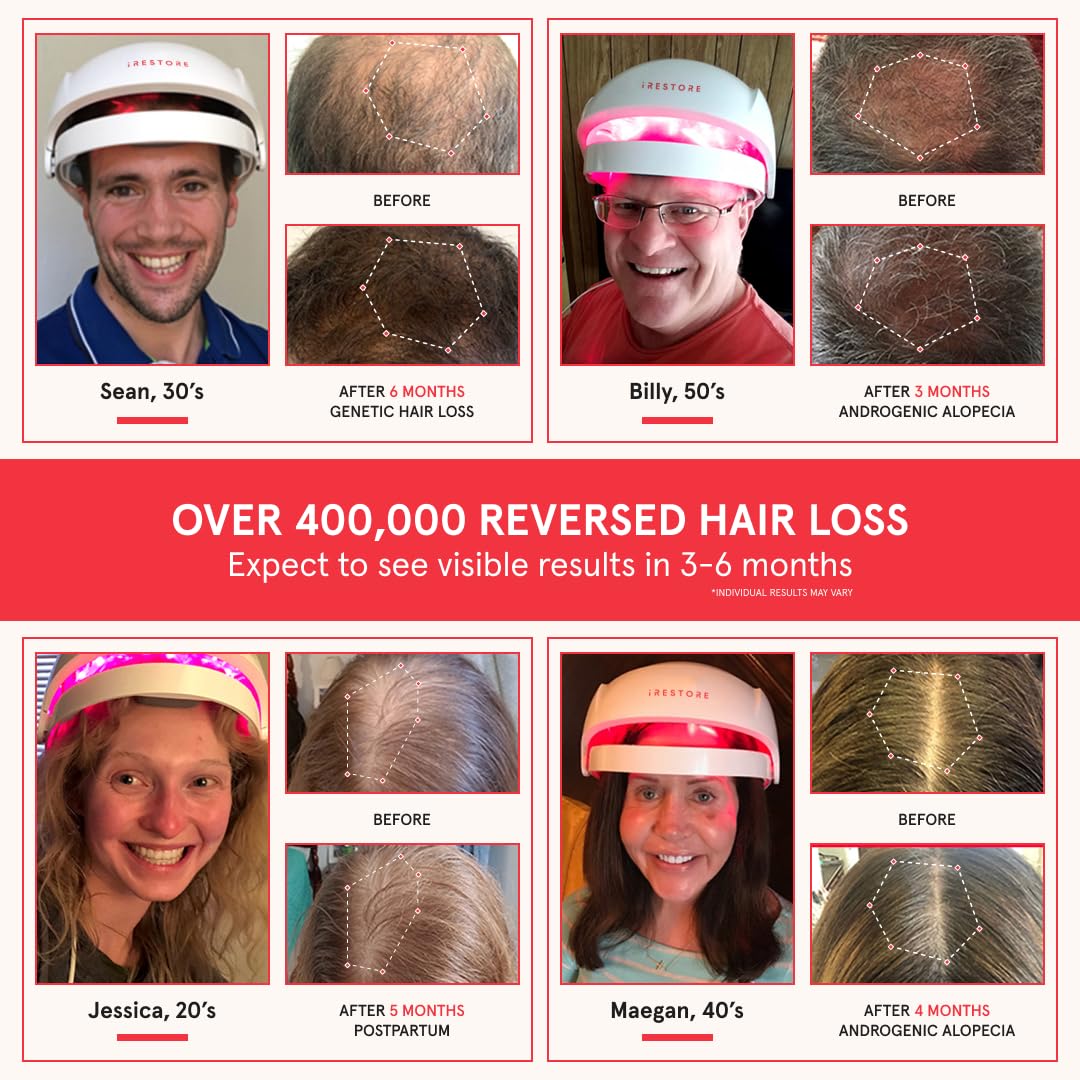 iRestore Essential - Laser Red Light Therapy for Hair Growth - FDA Cleared Hair Loss, Hair Thinning & Alopecia Treatment for Men & Women