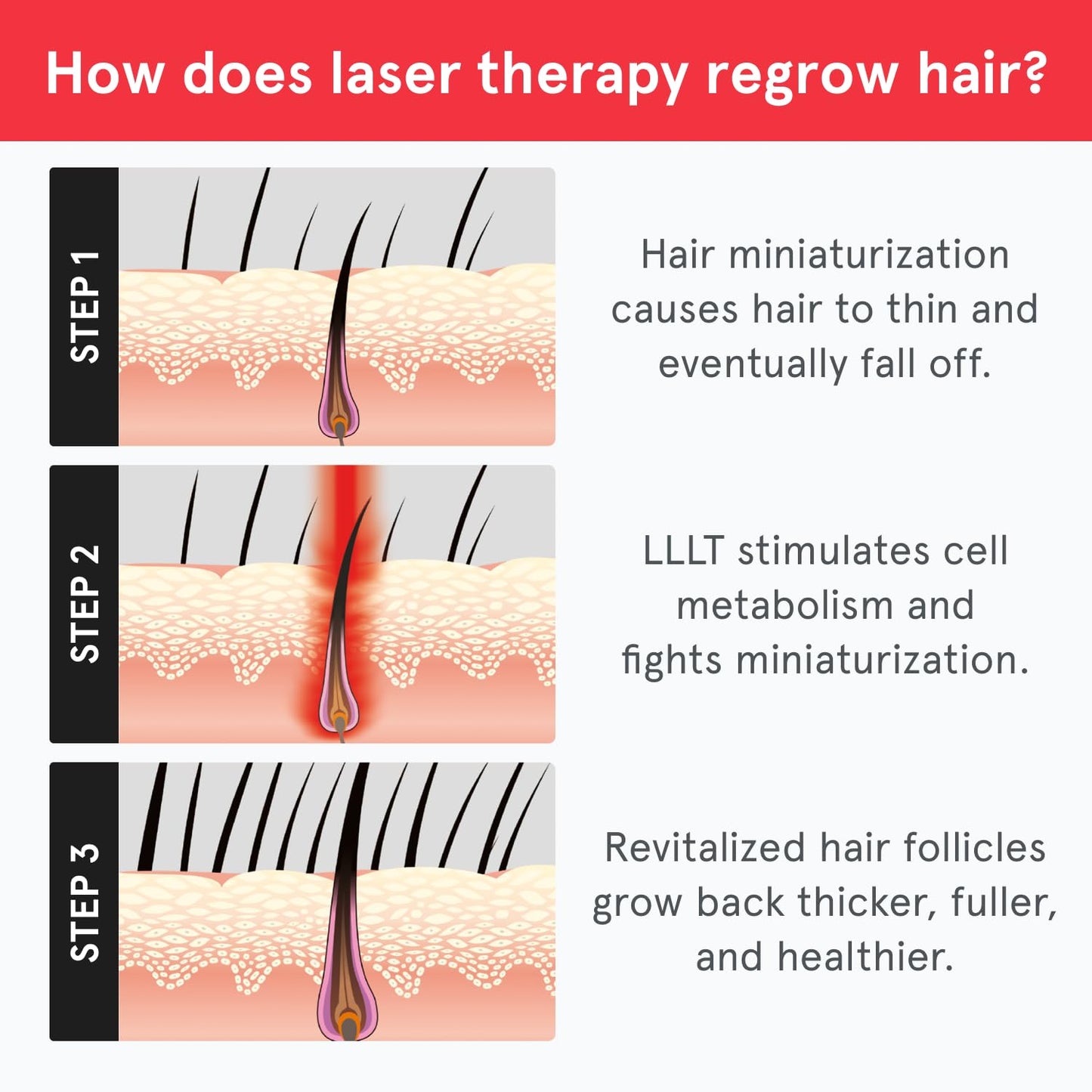 iRestore Essential - Laser Red Light Therapy for Hair Growth - FDA Cleared Hair Loss, Hair Thinning & Alopecia Treatment for Men & Women