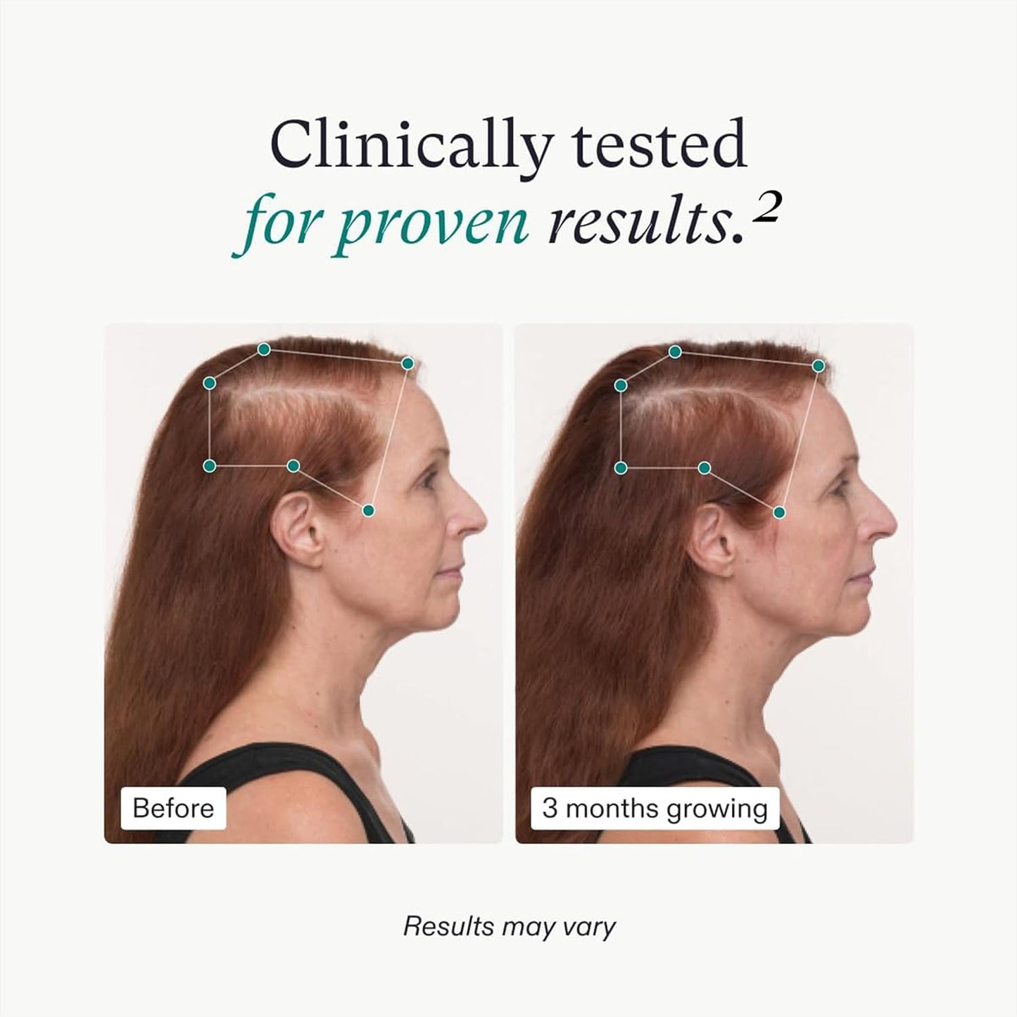 Nutrafol Women's Balance Hair Growth Supplements, for Ages 45+, Clinically Proven for Visibly Thicker Hair and Scalp Coverage, Dermatologist Recommended - 2 Month Supply, 2 Refill Pouches