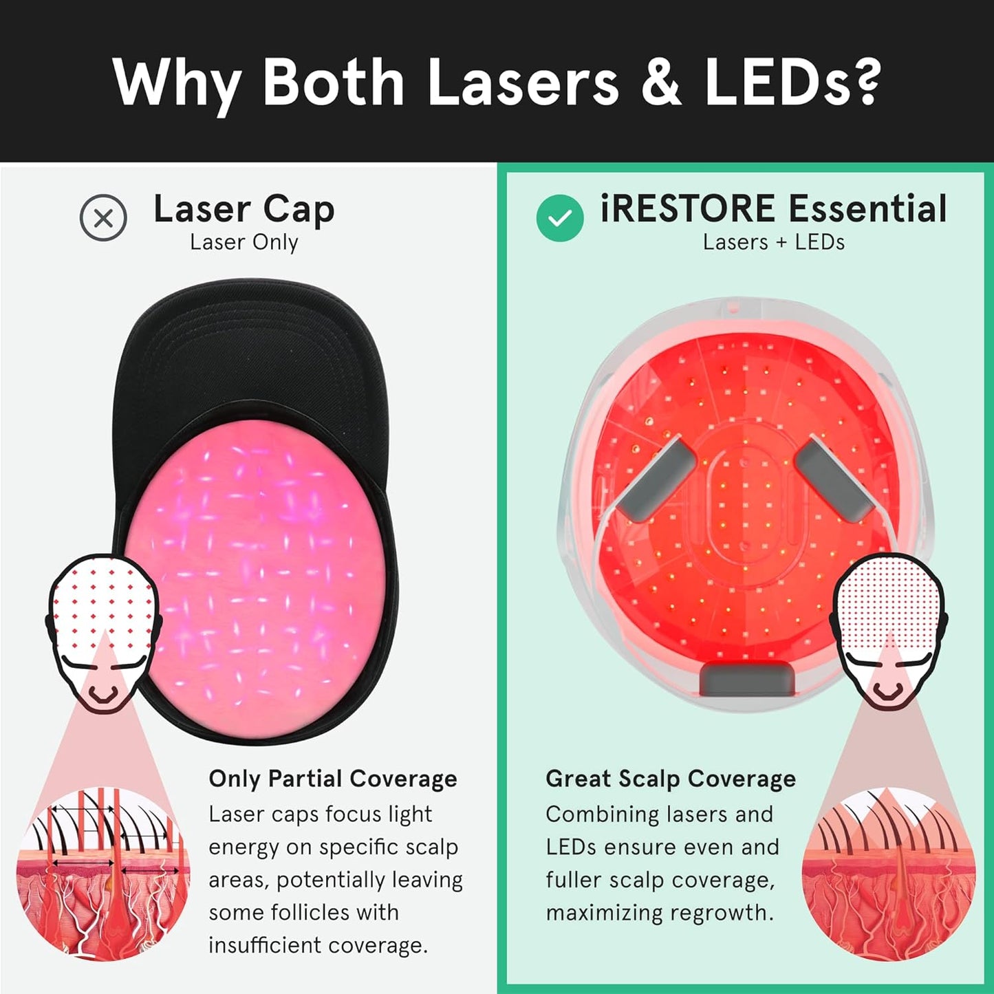 iRestore Essential - Laser Red Light Therapy for Hair Growth - FDA Cleared Hair Loss, Hair Thinning & Alopecia Treatment for Men & Women