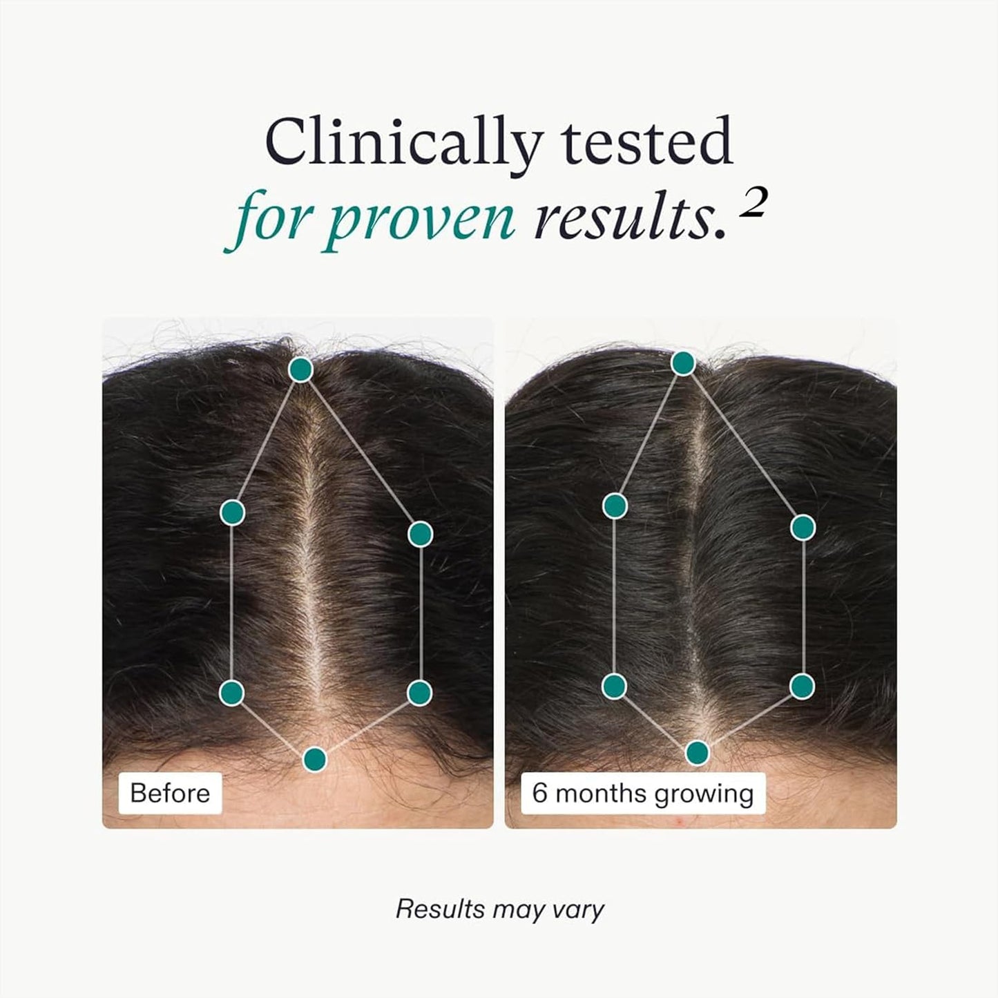 Nutrafol Women's Hair Growth Supplements, Ages 18-44, Clinically Proven for Visibly Thicker and Stronger