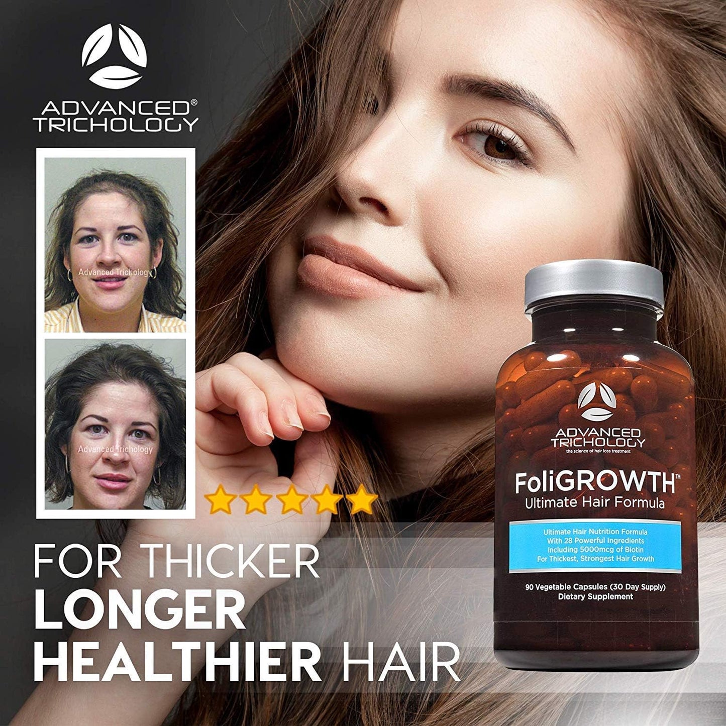FoliGROWTH™ Hair Growth for Thicker Fuller Hair Approved* by the American Hair Loss Association Revitalize Thinning Hair, Backed Hair Loss Clinic