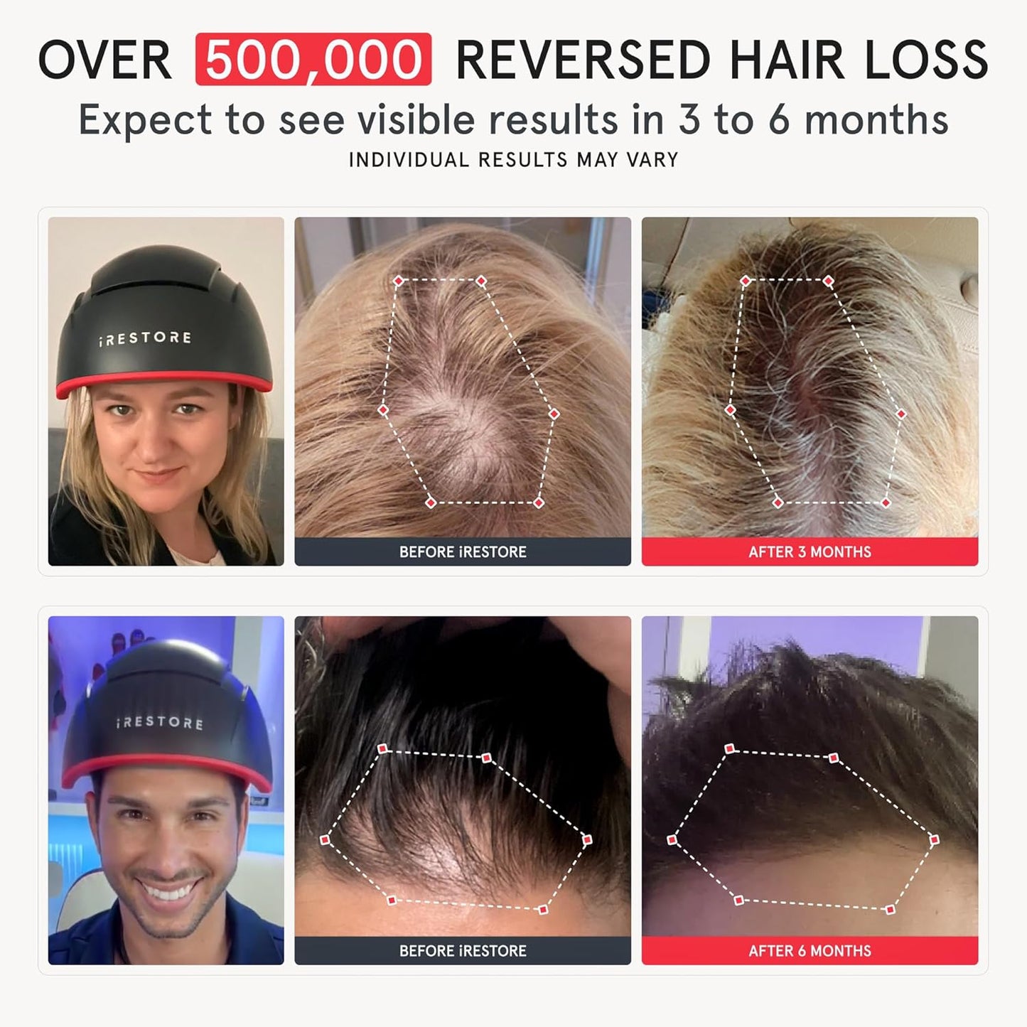 iRestore Skincare & Hair Care Power Duo – LED Therapy for Radiant Skin & Laser Hair Growth System